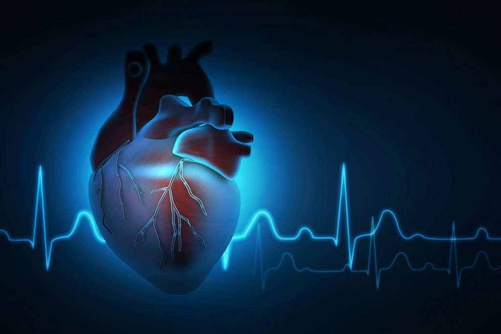 Demystifying Heart Arrhythmias